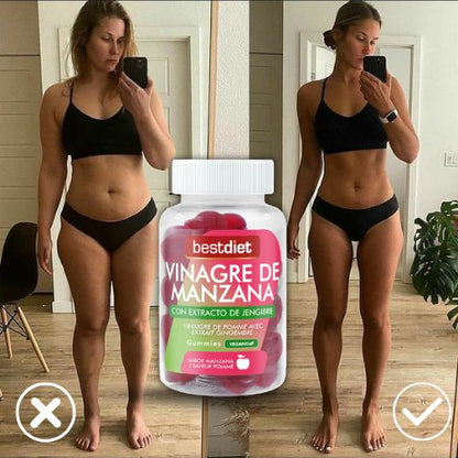 Gummies de Vinagre de Manzana – Apoyo Digestivo y Energía Natural